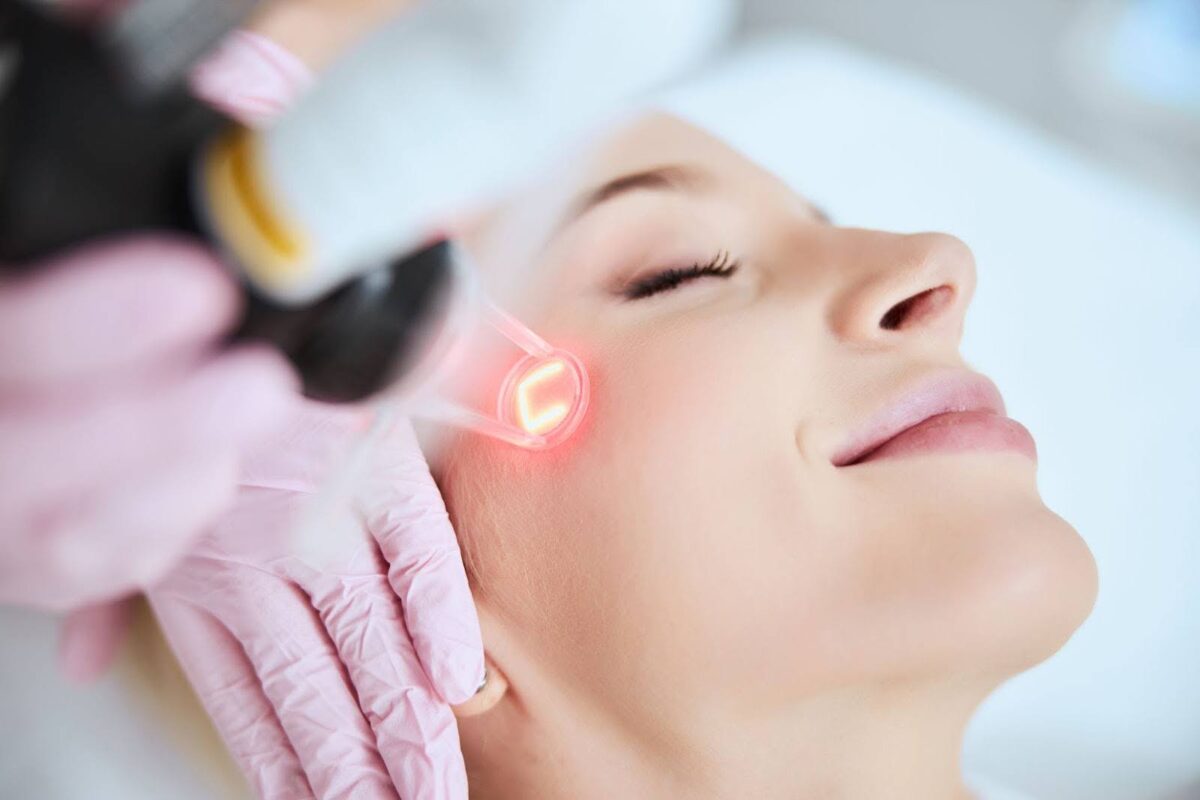 fractional laser